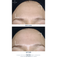 Exoniacinamide Booster Serum