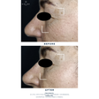 Exopeptide Booster Serum Sample