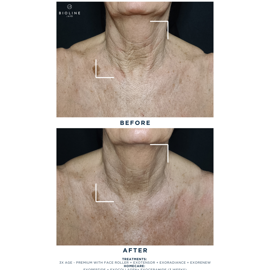 Exoceramide Booster Serum