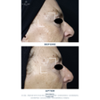 Exocollagen Booster Serum Sample